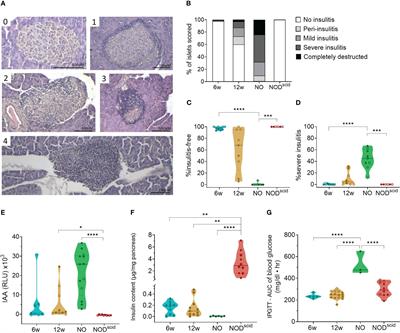 Footprint of pancreas infiltrating and circulating immune cells throughout type 1 diabetes development